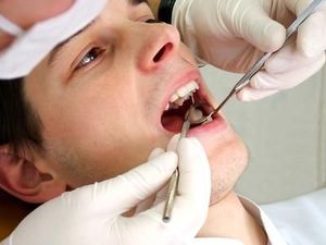 Dent sur pivot Est ce la solution durable à vos problèmes dentaires