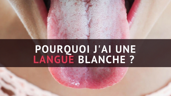 Langue Blanche Ou Langue Saburrale : Faut-il S'inquiéter ? - Zonedentaire